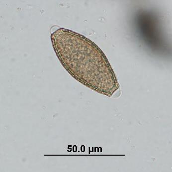 µm Trichuris spp.