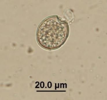 Entamoeba sp. cysts Length 12.5-20 µm; width 12.