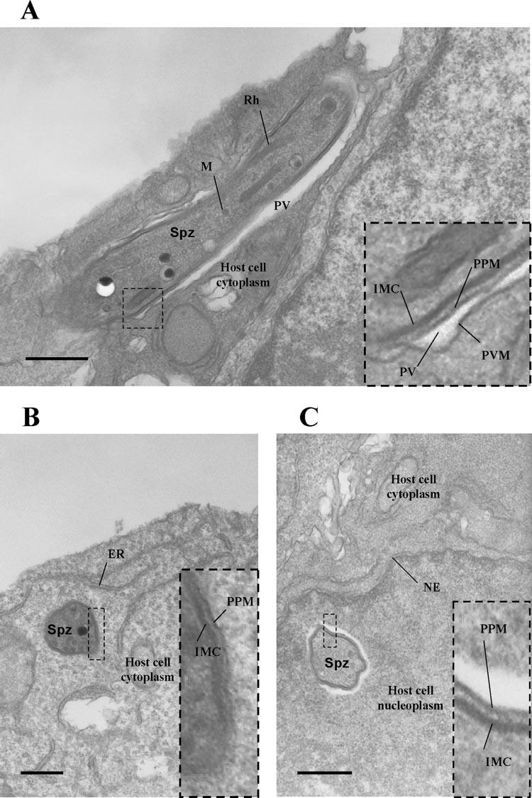 VOL. 75, 2007 P. YOELII WITH SIMULTANEOUS DELETION OF P52 AND P36 3765 FIG. 6. Electron microscopic analysis confirms that p52/p36-deficient parasites cannot form a parasitophorous vacuole.