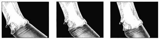 Severe toe-out No toe-out RUMP ANGLE - RA FOOT ANGLE - FA 1-5 pts.
