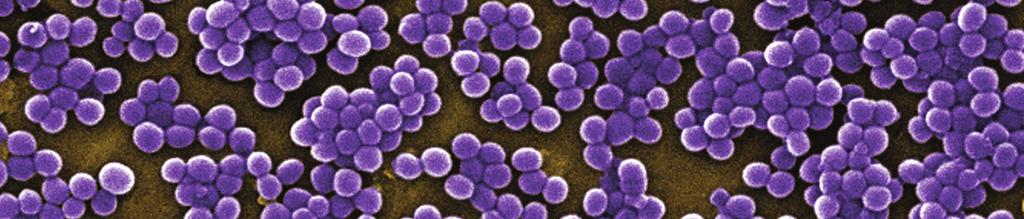 Facing the problem of antimicrobial resistance Photo: CDC/ Janice Carr Methicillin-resistant Staphylococcus Aureus, MRSA The World Health Organization, WHO, has named resistance to antimicrobial
