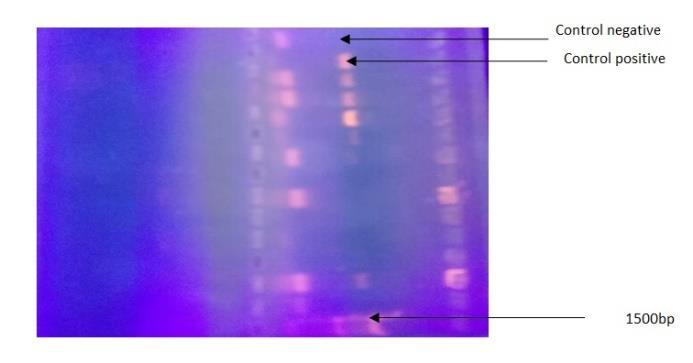 Figure (1): PCR amplification of the 16s of S.