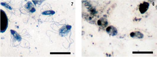 binucleate with prominent nucleolus 6-12 µm