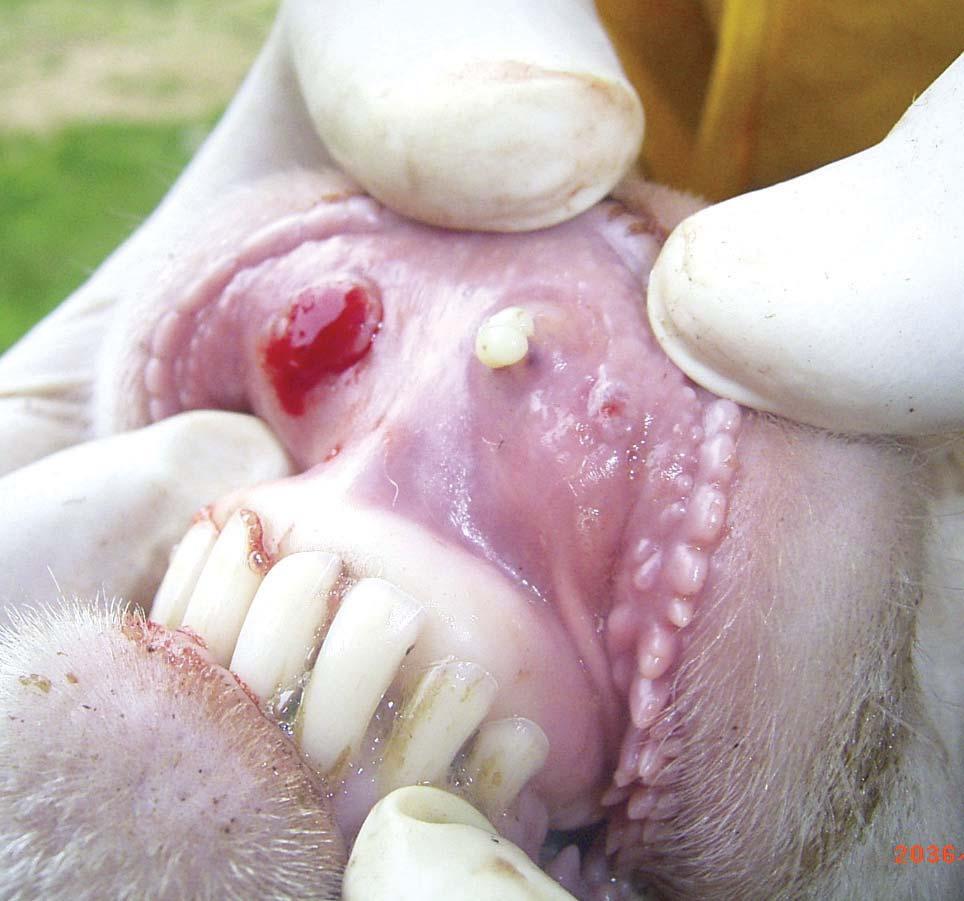 Five - Ulcer and abscess on the upper lip of a full mouth