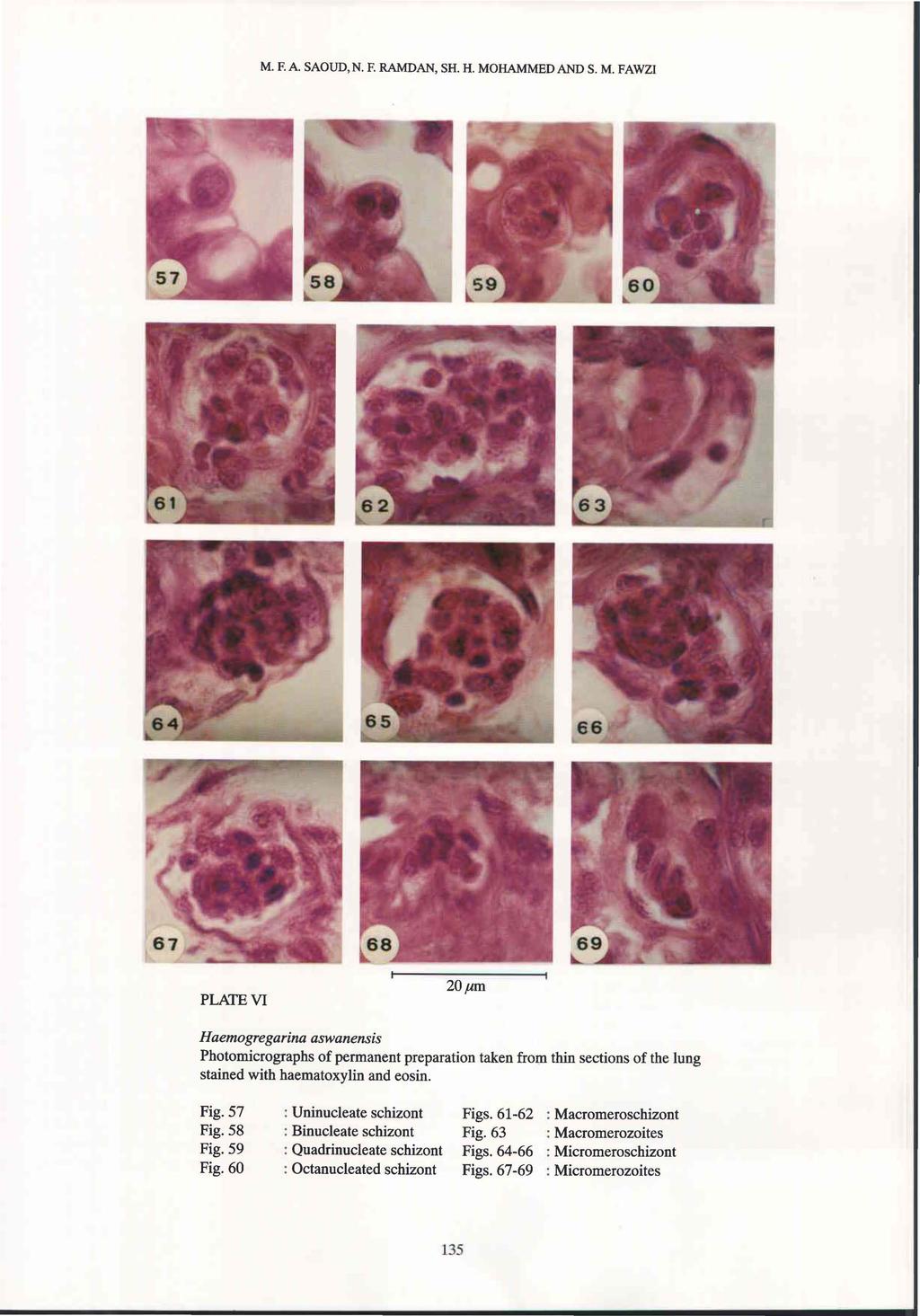 M.F.A. SAOUD, N. F. RAMDAN, SH. H. MOHAMMED AND S. M. FAWZl PLATE VI 20pm Haemogregarina aswanensis Photomicrographs of permanent preparation taken from thin sections of the lung stained with haematoxylin and eosin.