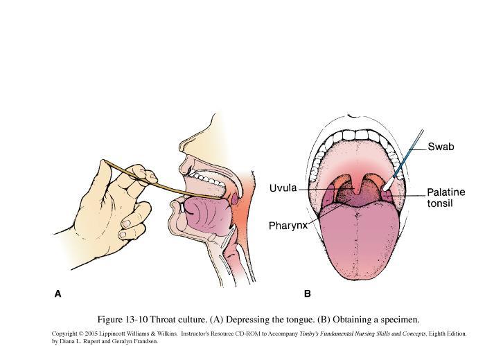 Pharyngitis Formal throat culture is taken What do you want to do now?