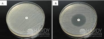 aureus White or golden Methicillin and Vancomycin Mannitol Salt Yellow Other Staphylococci Same