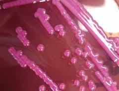 spp. MacConkeys Pink (lactose fermenters) Klebsiella spp.