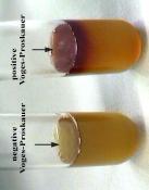 biochemical tests are used to dist Black colour Gelatin Vogues Proskauer (VP) It tests the ability of