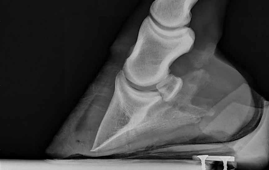 LAMINITIS IN HORSES DEFINITION: LAMINITIS = inflammation of the sensitive lamellae in the hoof leading to failure of attachment between the distal phalanx and the inner hoof wall.