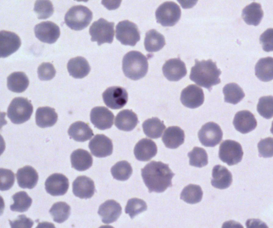 6 Journal of Parasitology Research Figure 2: Shows detection Babesia spp. in bushbuck (Tragelaphus scriptus).