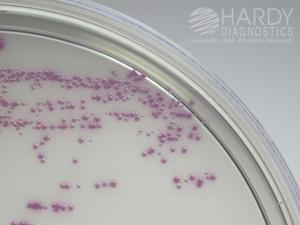 Methicillin-resistant Staphylococcus aureus (ATCC 43300) growing on HardyCHROM MRSA showing deep pink colonies. Incubated aerobically for 24 hours at 35ºC.