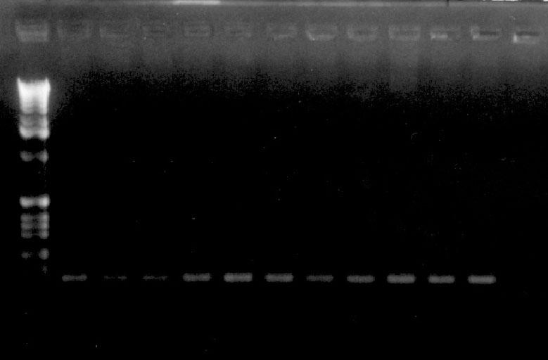 - 8 µl Taq Master Mix; - sterilna deionizirana voda do 25 µl; Za izvođenje reakcija koristio sam aparat PerkinElmer GeneAmp PCR System 2400.
