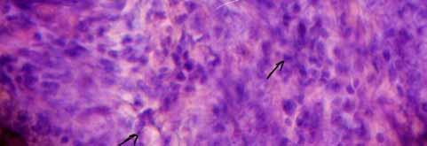 Fibroblasts, angioblasts and newly formed capillaries