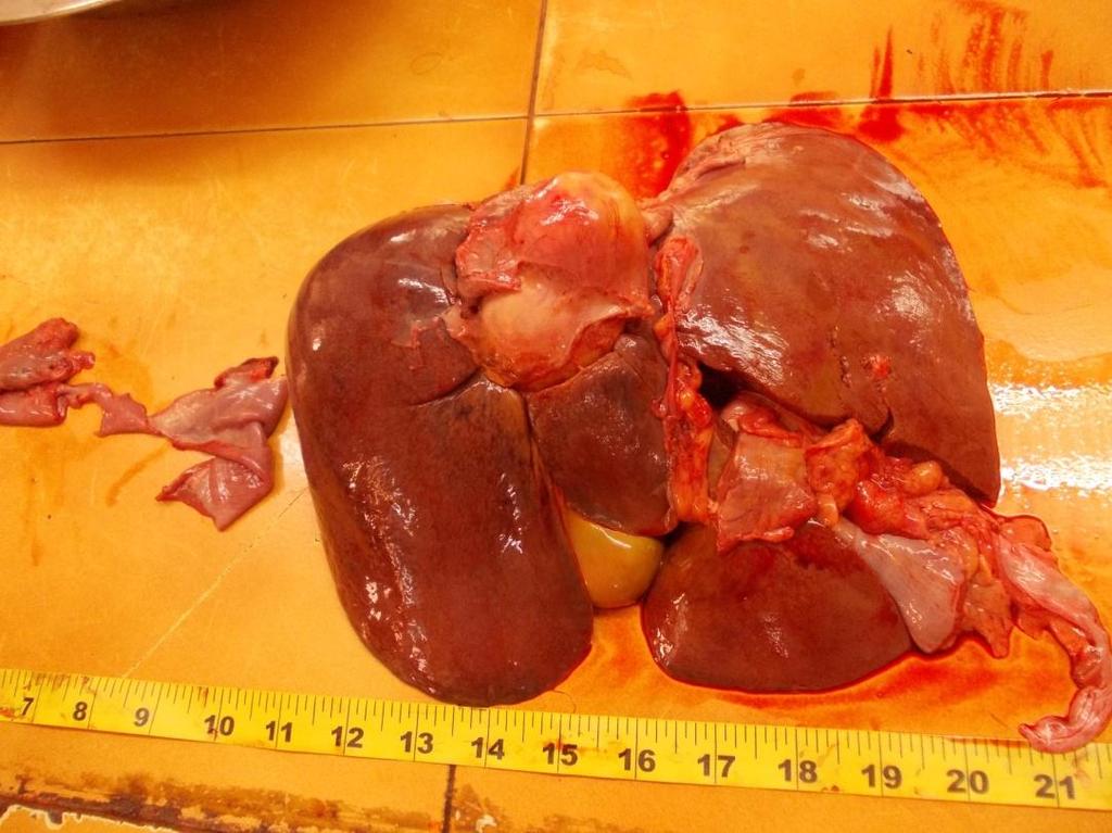 Fig : 1 Liver with Hydatid cyst (Fresh Specimen) and cyst is