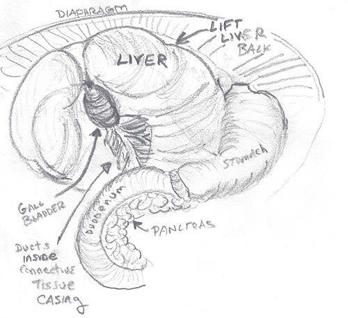 Locate the liver and gall bladder. ID the falciform ligament. Find the 3 ducts: hepatic, cystic and common bile.