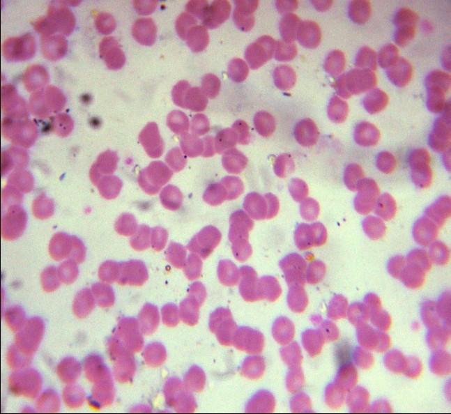Fig.1 Slides of blood Smear showing the presence of Anaplasma Spp. Fig: 1, Theileria Spp. Fig: 2 and Babesia Spp. Fig: 3.