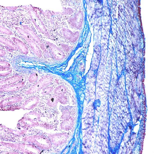 Fig.4 Photomicrograph showing blue colored collagen fibres (arrow) in core of villi, tunica submucosa and