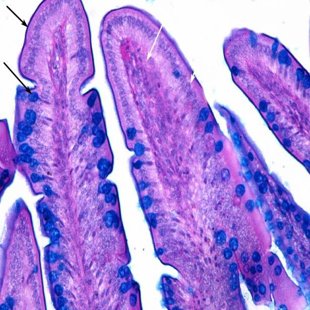 5 Photomicrograph showing Alcian blue activity (black arrow) in tip of villi and goblet cells and PAS