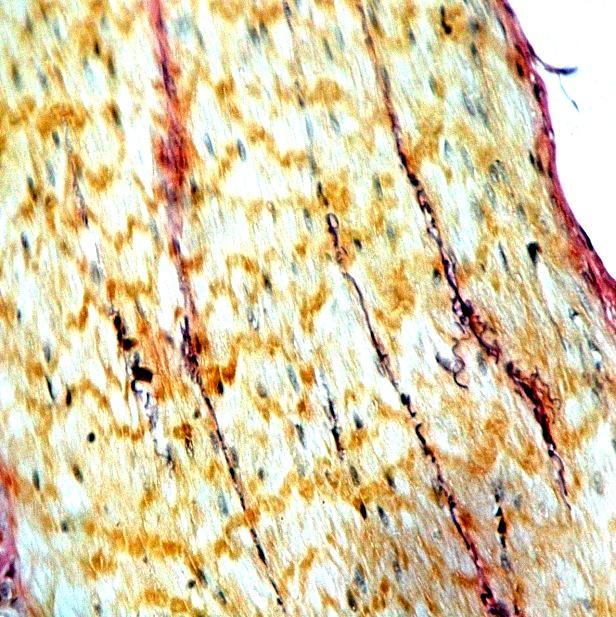 Fig.6 Photomicrograph showing black colored elastic fibres (arrow) in between muscle bundles of colorectum in 28 day old bird (Weigert s method X400) Fig.