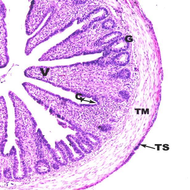 Fig.2 Photomicrograph showing long villi (V), crypts of lieberkuhn (CL), intestinal
