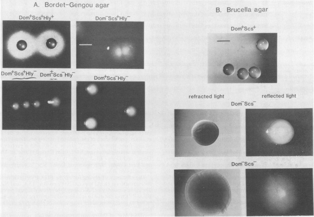 VOL. 44, 1984 RESULTS PVs, their colonial morphology on BGA, and frequency of variation. The majority of the B.