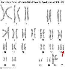 of chromosome (2n -1) 2.