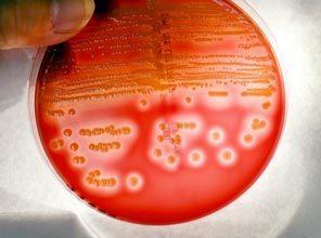 Identify the available antimicrobials for the treatment