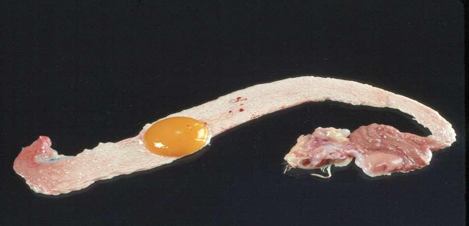 Sperm is deposited in vaginal area must reach infundibulum area