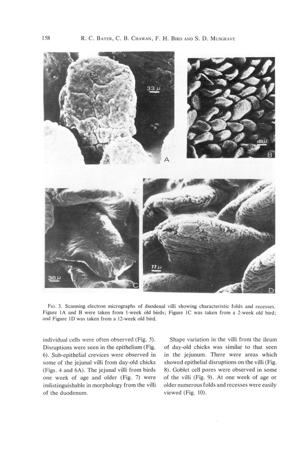 158 R. C. BAYER, C. B. CHAWAN, F. H. BIRD AND S. D. MUSGRAVE FIG. 3. Scanning electron micrographs of duodenal villi showing characteristic folds and recesses.