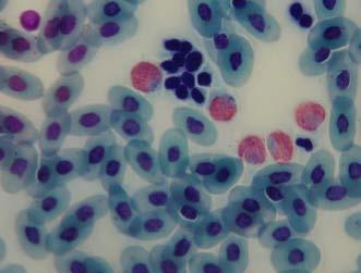 Heterophils with numerous red granules (white arrow); and thrombocytes (green arrow) (Wright stain, 100x) Discussion One of the most important functions of erythrocytes is to carry oxygen and carbon