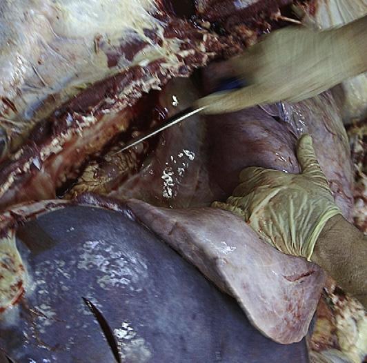 This flaps the right ventricle and allows an excellent view of the tricuspid valve.
