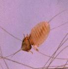 Order Psocodea (Lice) wingless louse Two groups: Bark and book lice (formally Psocoptera) scavengers that feed on fungi,