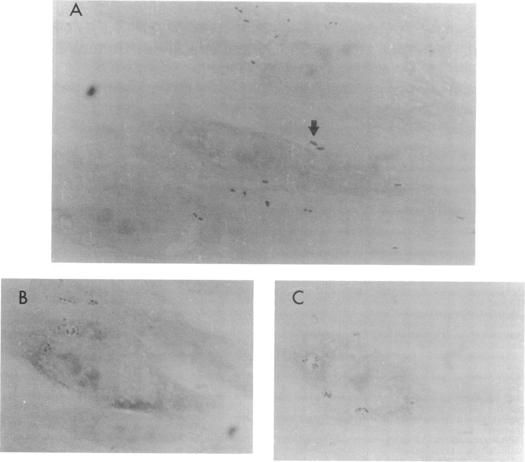 950 NOUMI ET AL. ANTIMICROB. AGENTS CHEMOTHER. Downloaded from http://aac.asm.org/ _~~~~~ -X FIG. 1. Micrographs of a WI-38 cell incubated with S. enteritidis C-32.