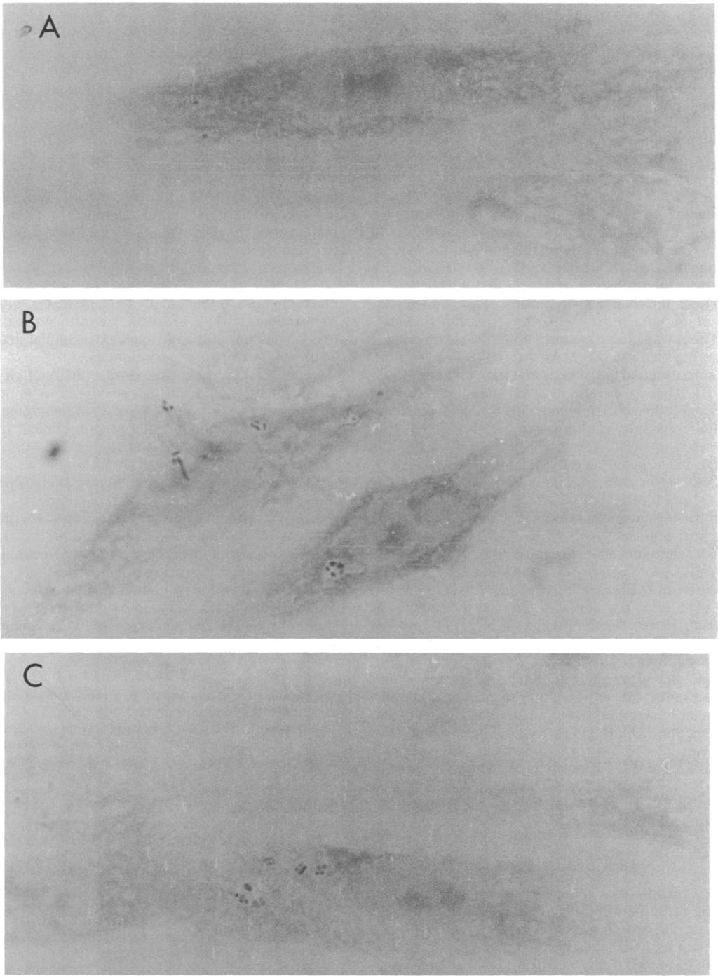 VOL. 34, 1990 INTRACELLULAR ACTIVITY OF TOSUFLOXACIN 951 FIG. 2. Micrographs of infected WI-38 cells after incubation with tosufloxacin (A), ofloxacin (B), and norfloxacin (C).