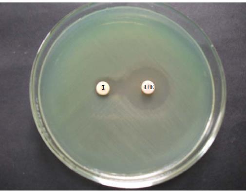Klebsiella spp was the commonest isolate (28.47%) followed by E.coli (26.