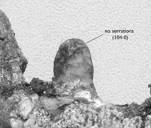 TURNER AND CALVO NEW SEBECOSUCHIAN FROM PATAGONIA 91 FIGURE 4. Detail of fifth dentary tooth illustrating the lack on serrations on the carina (character 104 0). dorsal view.