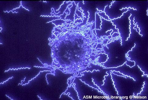 Scanning Electron Microscope Image (CDC) Dark