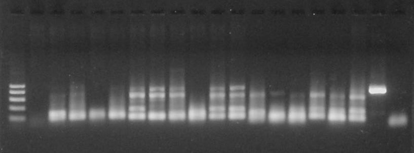 216 M 1 2 3 4 5 6 7 8 9 10 11 12 13 14 15 16 18 KP KN 442 bp Fig. 1. PCR amplification product of Borrelia burgdorferi sensu lato in Ixodes ricinus on agarose gel after ethidium bromide staining.