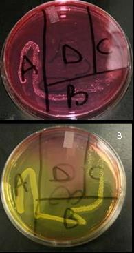Panton-Valentine Leukocidin Genes in MRSA Isolates 99 The 16S rrna sequence for S. aureus, Sa16, was used as an internal control.