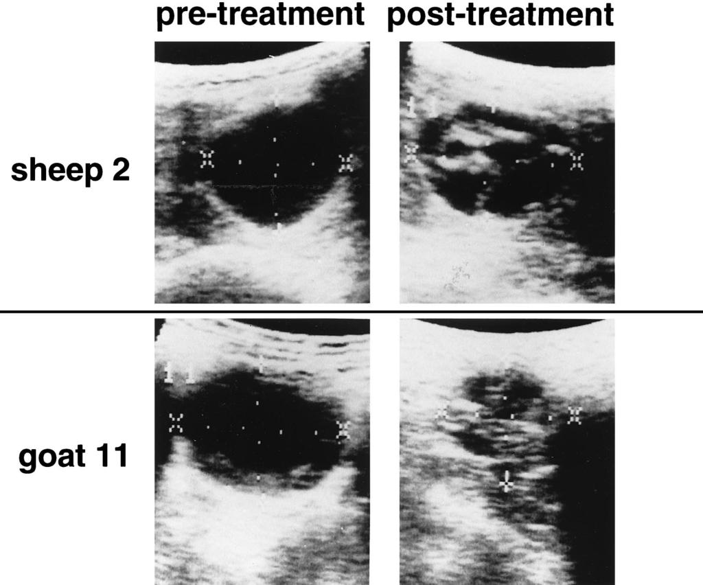 VOL. 42, 1998 OXFENDAZOLE FOR HYDATID DISEASE 603 FIG. 2. Ultrasound changes in hydatid cysts in liver tissue before and after 4 weeks of oxfendazole therapy.