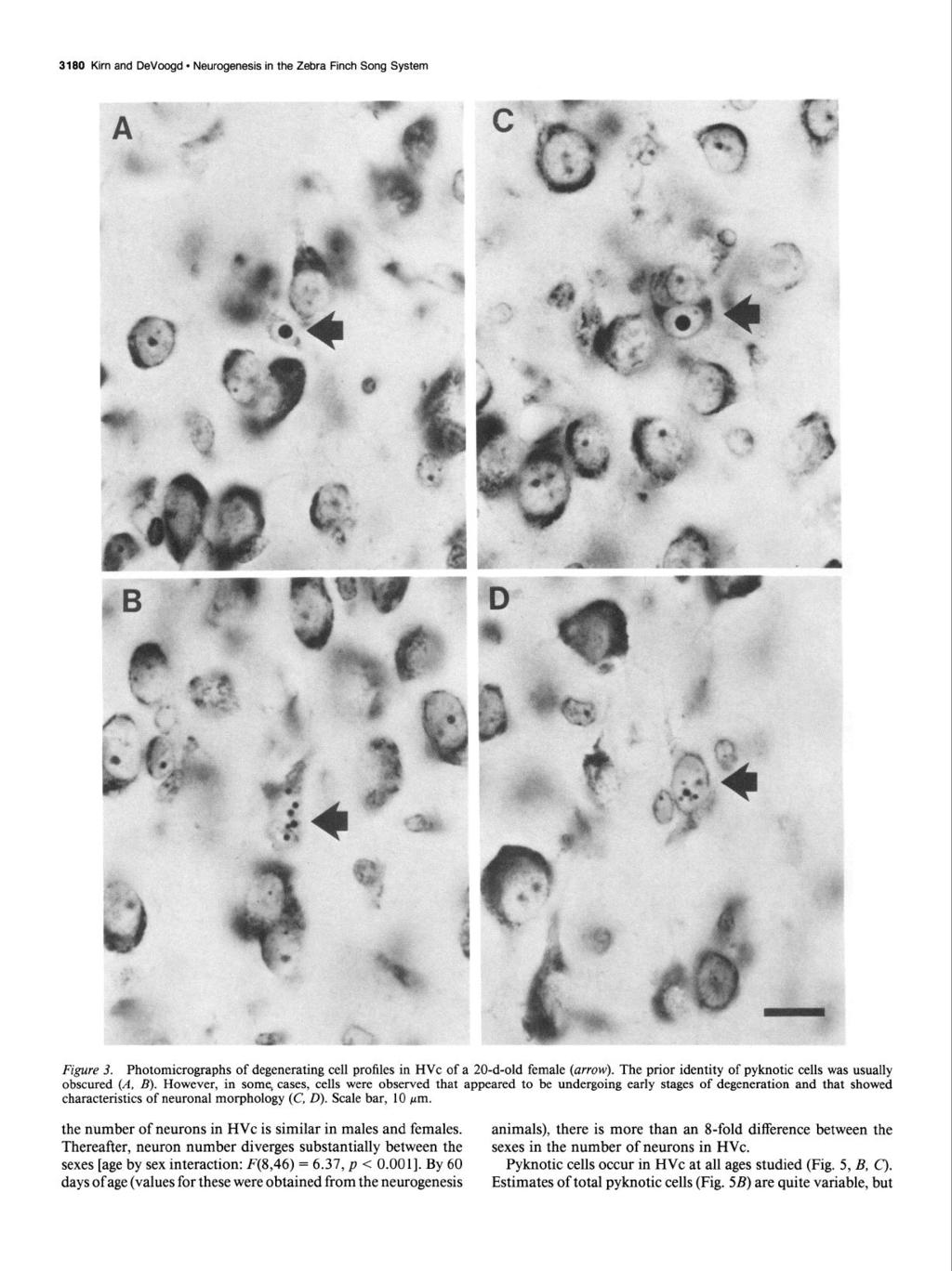 3180 Kirn and DeVoogd - Neurogenesis in the Zebra Finch Song System Figure 3. Photomicrographs of degenerating cell profiles in HVc of a 20-d-old female (arrow).