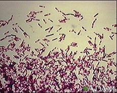 Clostridium difficile various strains Opportunistic toxin producing in colon fecal-oral route spread spores can survive