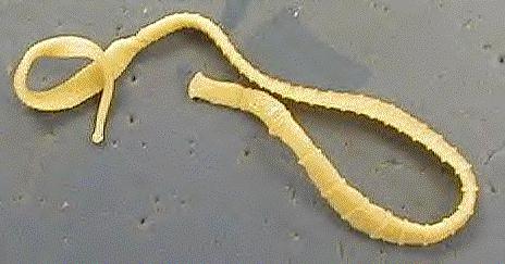 Invertebrates Flatworms Flat thin bodies Digestive system has