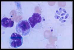 Tissue cysts containing bradyzoites in undercooked or