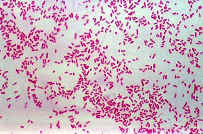 E. coli Infection A.K.A. E. coli peritonitis, colibacillosis E.