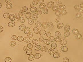 Coccidiosis Protozoal disease 9 species of Eimeria: E. acervulina E. necatrix E. maxima E. brunetti E. tenella E.