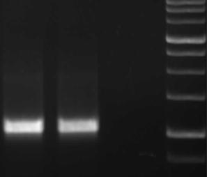 Standard Agglutination Test standard globally Four-fold rise or single titer