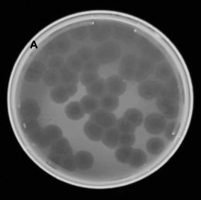 (BHI, HIB, blood agar, MacConkey agar) and identification