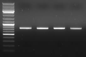 Primary isolation takes 48-72 h PCR, immunoassays for confirmation Serology: